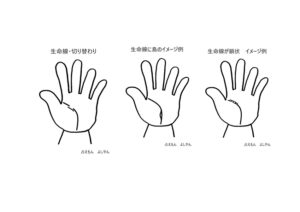 生命線２